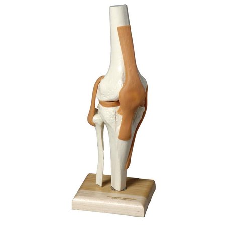 DENOYER-GEPPERT Anatomical Model, Ultraflex Ligamented Functional Knee Replica SJ66K